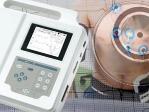 Elektrokardiyogram / EKG Cihazı Nedir?